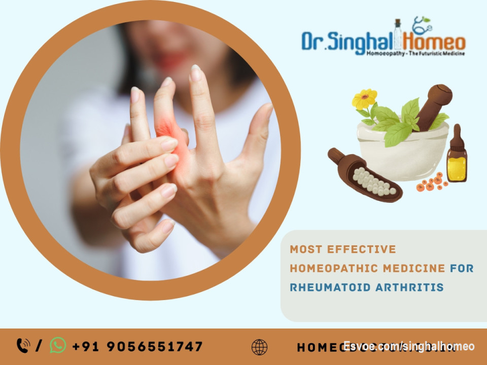 Affordable Homeopathic Medicines for Rheumatoid Arthritis – Dr. Singhal Homeo

Looking for effective and affordable relief from rheumatoid arthritis? At Dr. Singhal Homeo clinic, we offer Homeopathic Medicines for Rheumatoid Arthritis that are customized to each patient’s condition. These gentle yet powerful remedies help reduce joint pain, stiffness, and swelling while supporting overall well-being. Along with lifestyle changes and regular follow-ups, our holistic treatment approach helps improve mobility and quality of life naturally. For more information, call or WhatsApp us at +91 9056551747.

Visit our website at:
https://homeodoctor.co.in/top-homeopathic-medicines-for-rheumatoid-arthritis-natural-relief-for-joint-pain/

#HomeopathicMedicinesforRheumatoidArthritis
#Homeopathy
#HomeopathicMedicine